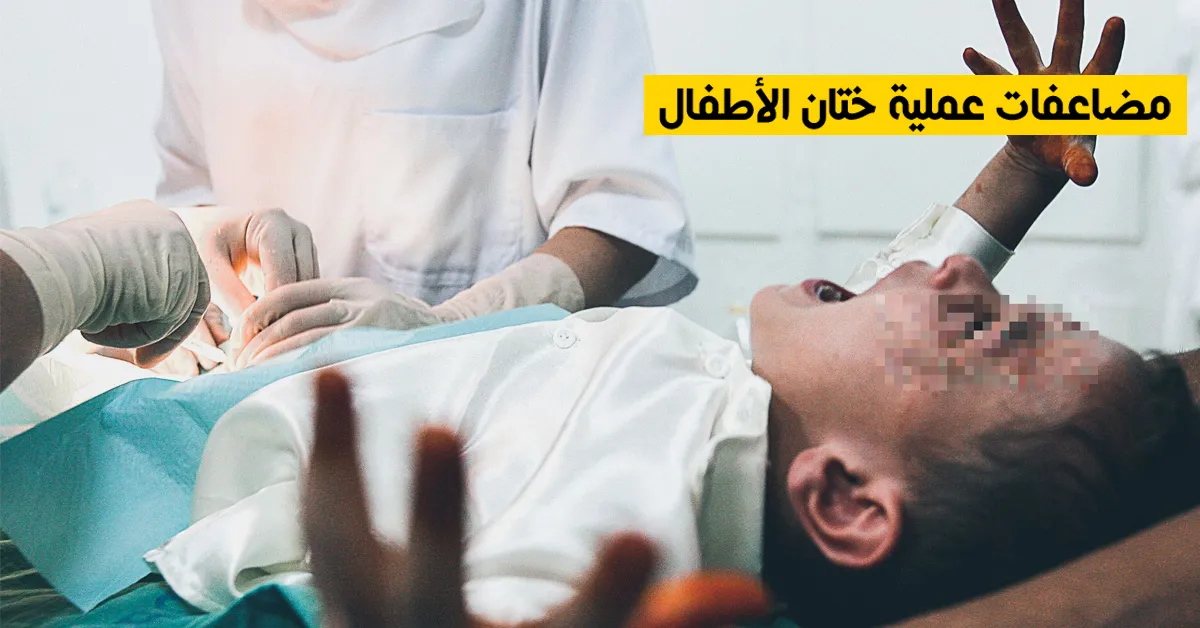 مضاعفات عملية ختان الأطفال